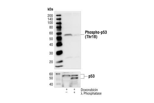  Image 4: Phospho-p53 Antibody Sampler Kit