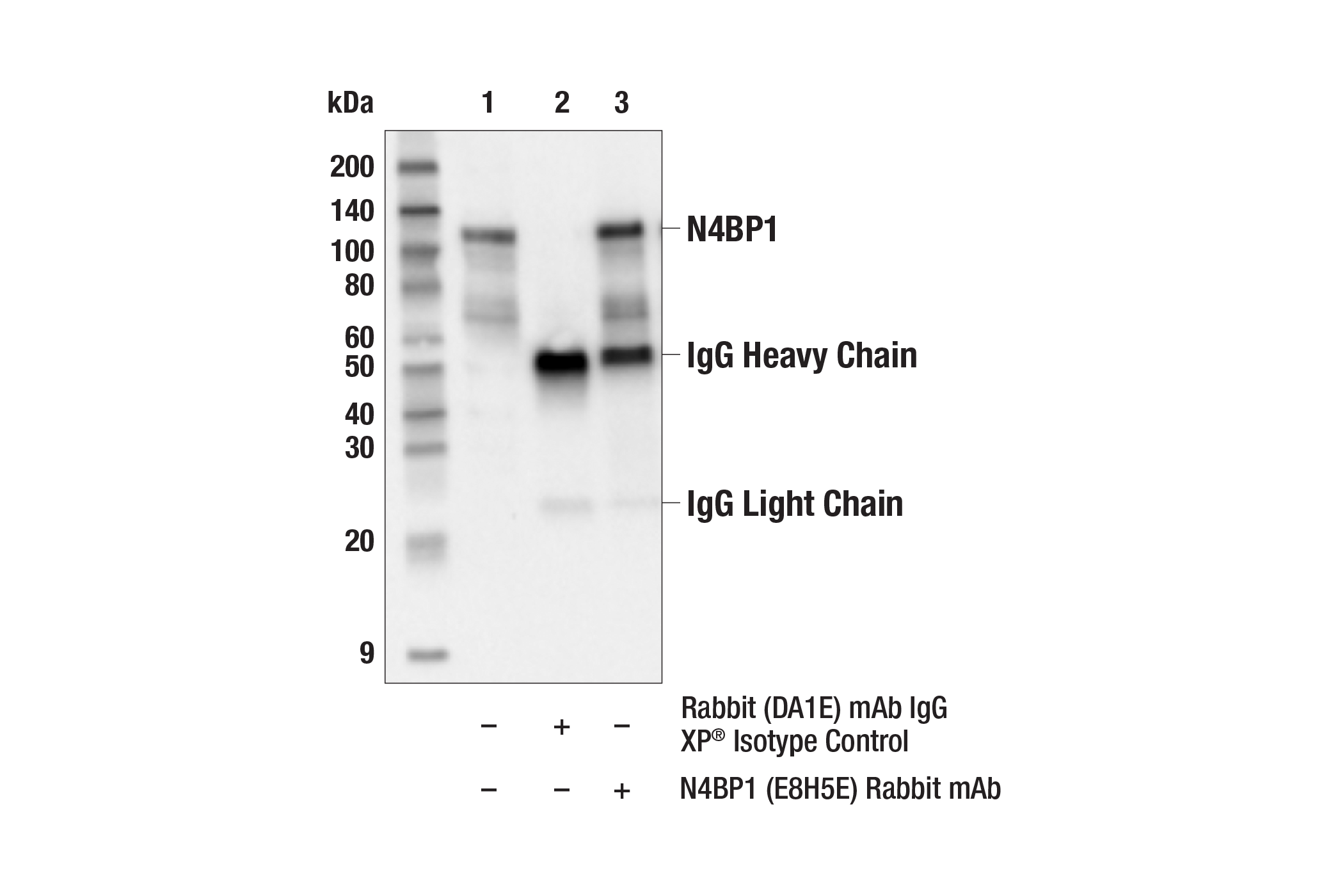 Immunoprecipitation Image 1: N4BP1 (E8H5E) Rabbit mAb