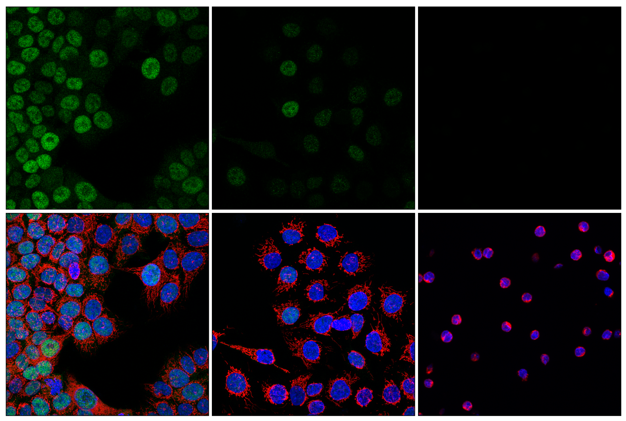 Immunofluorescence Image 1: ID1 (F2M1J) Rabbit mAb (IF/Flow Formulated)