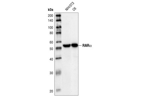 Western Blotting Image 1: RARα Antibody