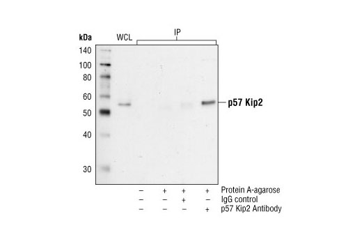 Immunoprecipitation Image 1: p57 Kip2 Antibody
