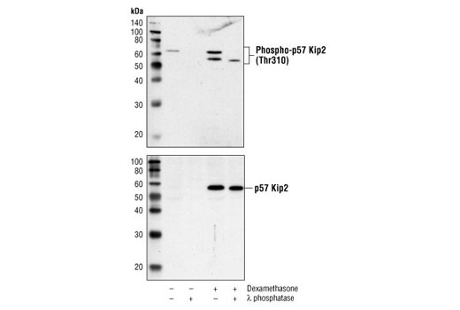 Western Blotting Image 1: Phospho-p57 Kip2 (Thr310) Antibody