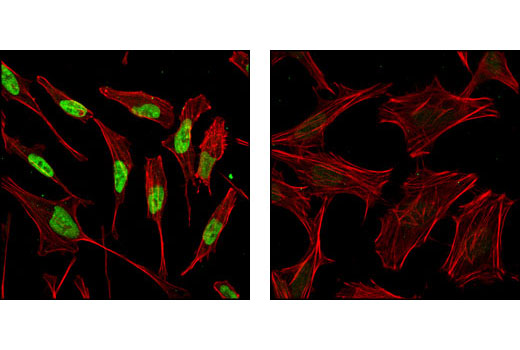 Immunofluorescence Image 1: Phospho-p57 Kip2 (Thr310) Antibody