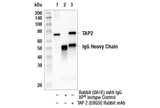 Immunoprecipitation Image 1: TAP2 (E8G5I) Rabbit mAb
