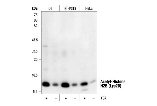 Western Blotting Image 1: Acetyl-Histone H2B (Lys20) Antibody
