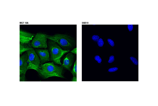 Immunofluorescence Image 1: Keratin 5 (D4U8Q) Rabbit mAb