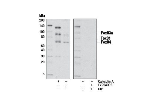  Image 15: Insulin/IGF-1 Signaling Pathway Antibody Sampler Kit