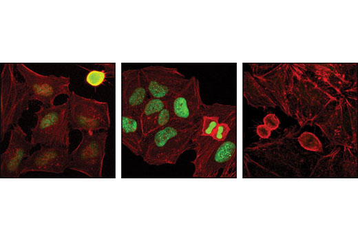 Immunofluorescence Image 1: Phospho-HP1γ (Ser83) Antibody