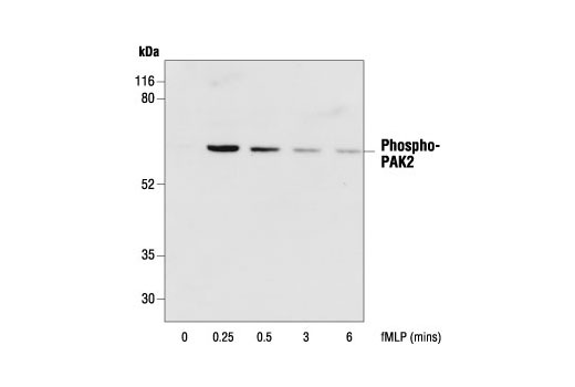 Western Blotting Image 1: Phospho-PAK1 (Thr423)/PAK2 (Thr402) Antibody