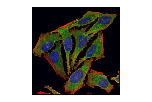 Immunofluorescence Image 1: Pan-Calcineurin A Antibody
