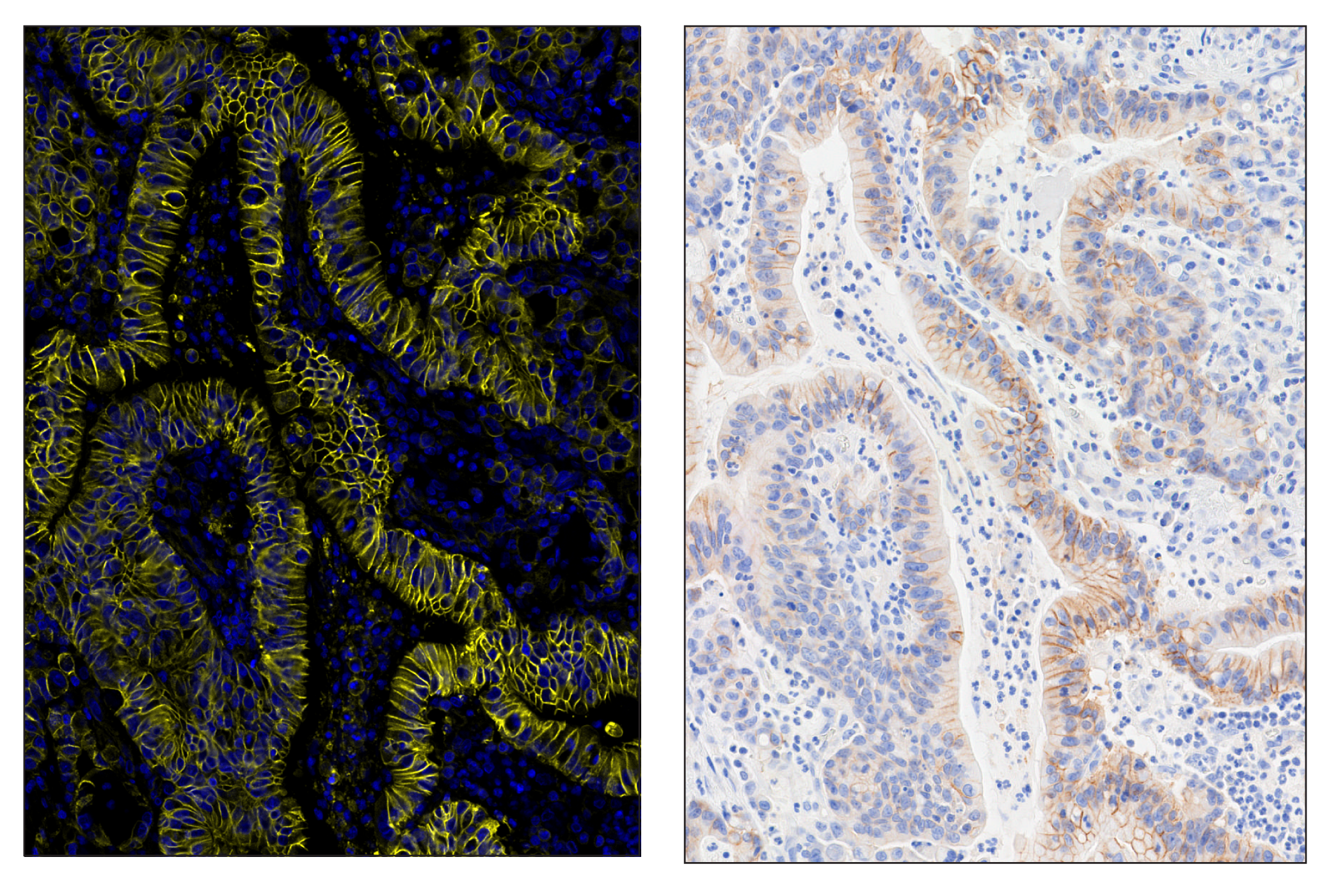 Immunohistochemistry Image 6: Na,K-ATPase α1 (D4Y7E) & CO-0079-594 SignalStar™ Oligo-Antibody Pair