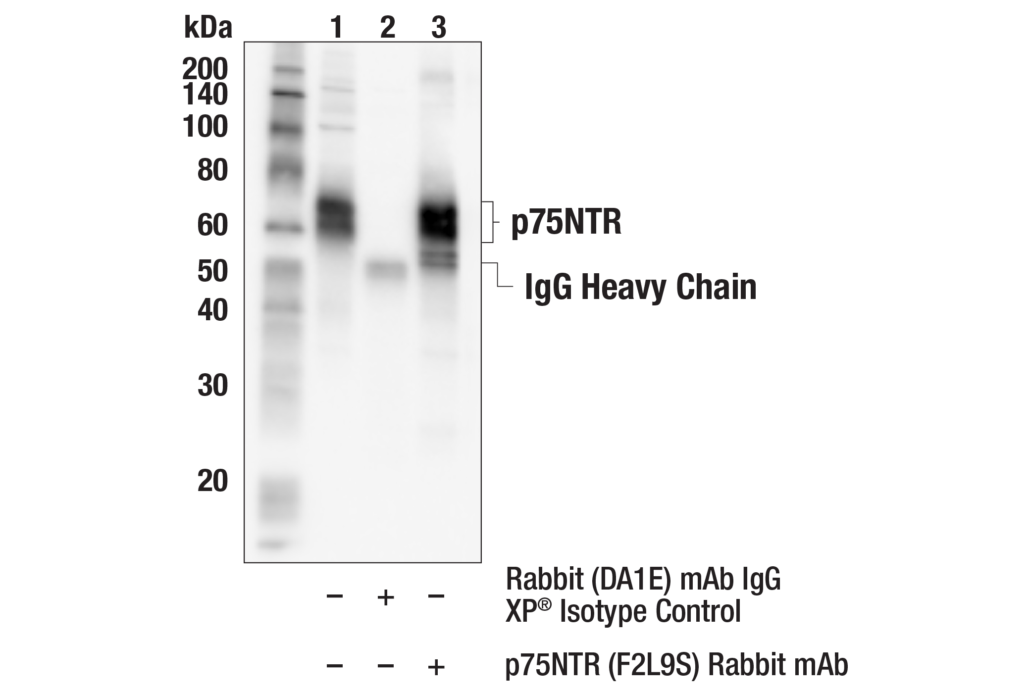 Immunoprecipitation Image 1: p75NTR (F2L9S) Rabbit mAb