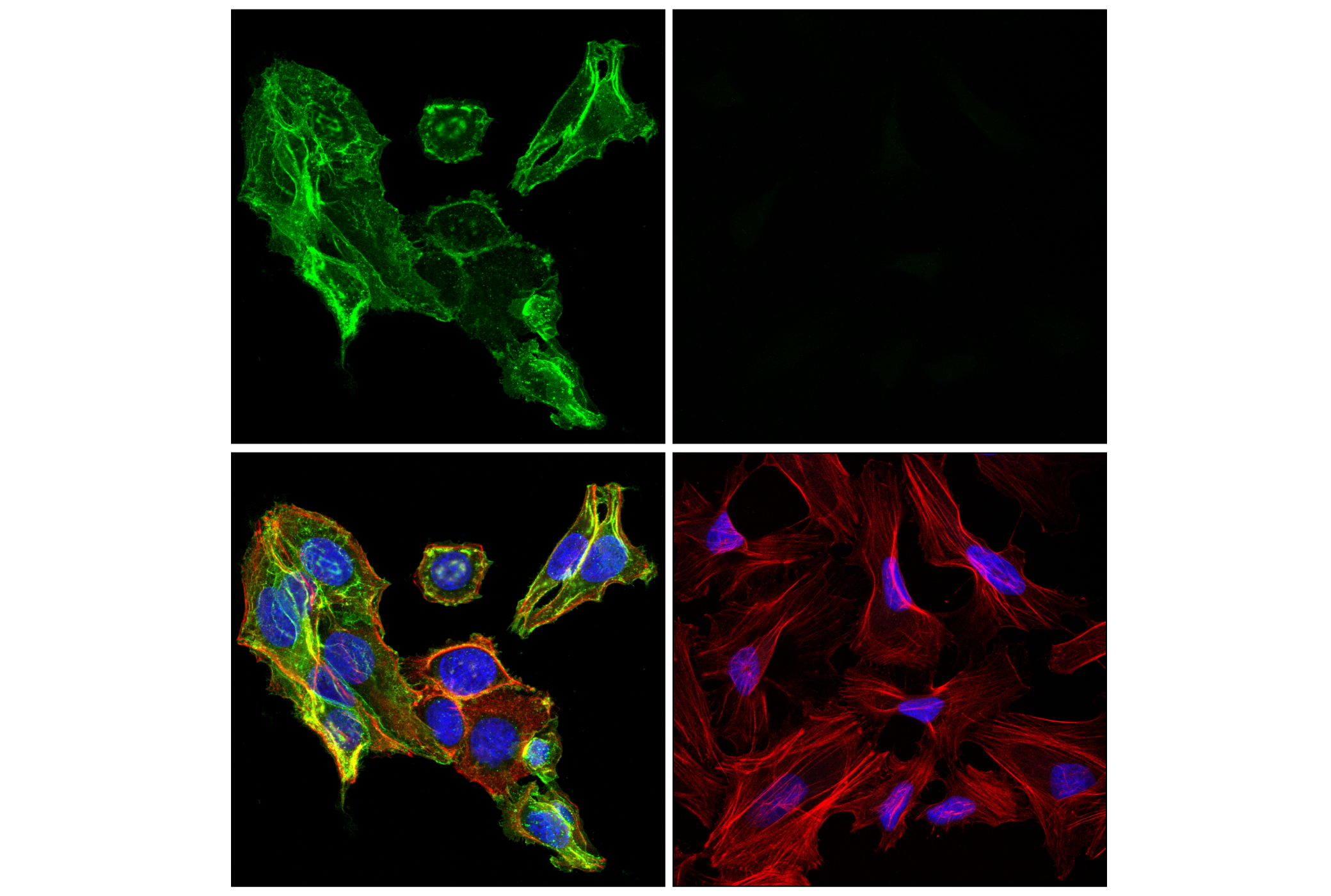 Immunofluorescence Image 4: p75NTR (F2L9S) Rabbit mAb