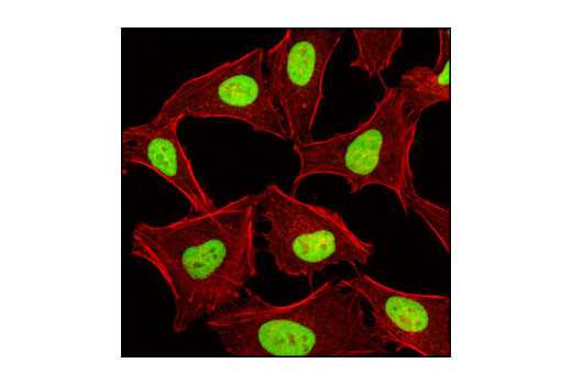 Immunofluorescence Image 1: JMJD1B/JHDM2B Antibody