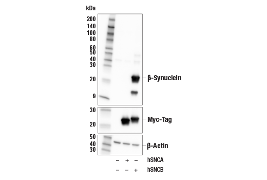 Western Blotting Image 1: β-Synuclein (E9R3I) Rabbit mAb