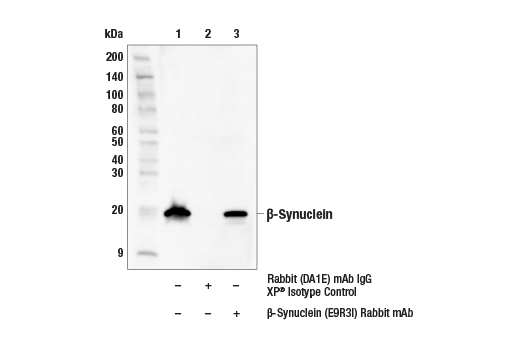 Immunoprecipitation Image 1: β-Synuclein (E9R3I) Rabbit mAb
