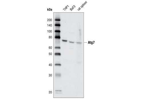 Western Blotting Image 1: Atg7 Antibody