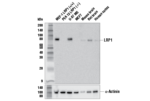  Image 10: ApoE Synaptic Formation and Signaling Pathway Antibody Sampler Kit