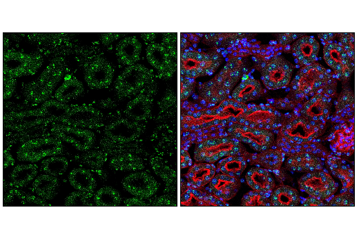  Image 2: Nucleus and Nuclear Envelope-Associated Marker Proteins Antibody Sampler Kit