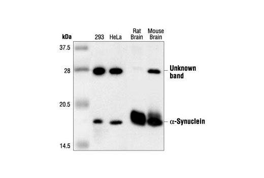 Western Blotting Image 1: α-Synuclein Antibody