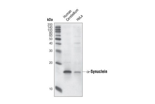 Western Blotting Image 1: α-Synuclein (Syn204) Mouse mAb