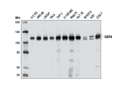 Western Blotting Image 1: USP4 Antibody