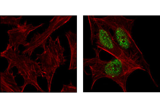 Immunofluorescence Image 1: Phospho-53BP1 (Ser1778) Antibody