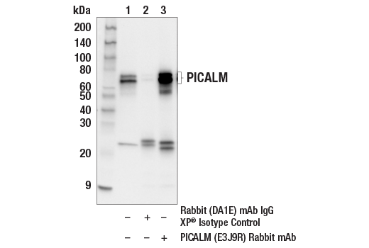  Image 22: PICALM Signaling Antibody Sampler Kit