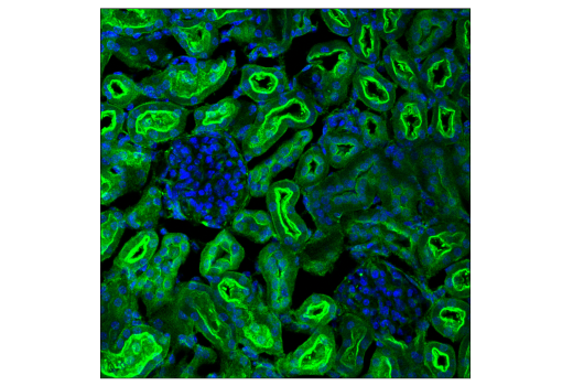 Immunofluorescence Image 3: PICALM (E3J9R) Rabbit mAb