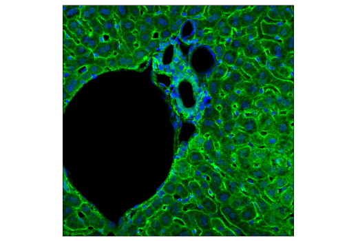 Immunofluorescence Image 4: PICALM (E3J9R) Rabbit mAb