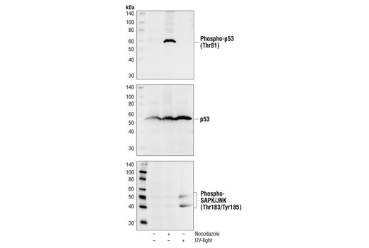 Western Blotting Image 1: Phospho-p53 (Thr81) Antibody