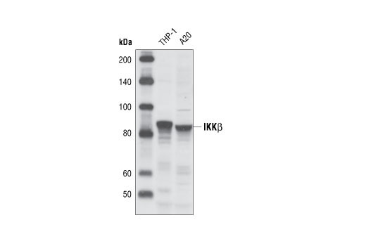 Western Blotting Image 1: IKKβ (L570) Antibody