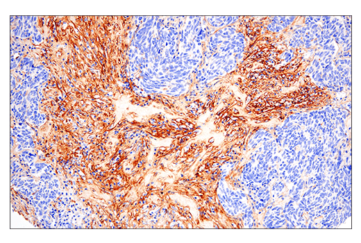 Immunohistochemistry Image 1: Fibronectin/FN1 (E5H6X) Rabbit mAb
