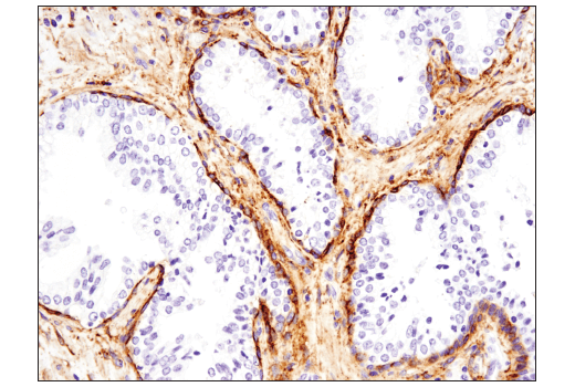 Immunohistochemistry Image 5: Podoplanin (LpMab-12) Mouse mAb