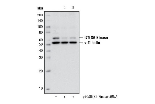  Image 14: p70 S6 Kinase Substrates Antibody Sampler Kit