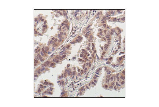 Phosphoplus P S Kinase Thr Antibody Duet Cell Signaling