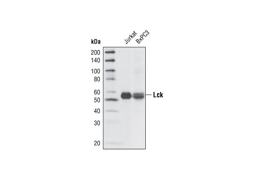 Western Blotting Image 1: Lck (V49) Antibody