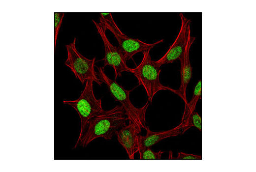  Image 19: Nucleus and Nuclear Envelope-Associated Marker Proteins Antibody Sampler Kit