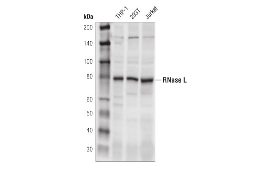  Image 5: OAS/RNase L Pathway Antibody Sampler Kit