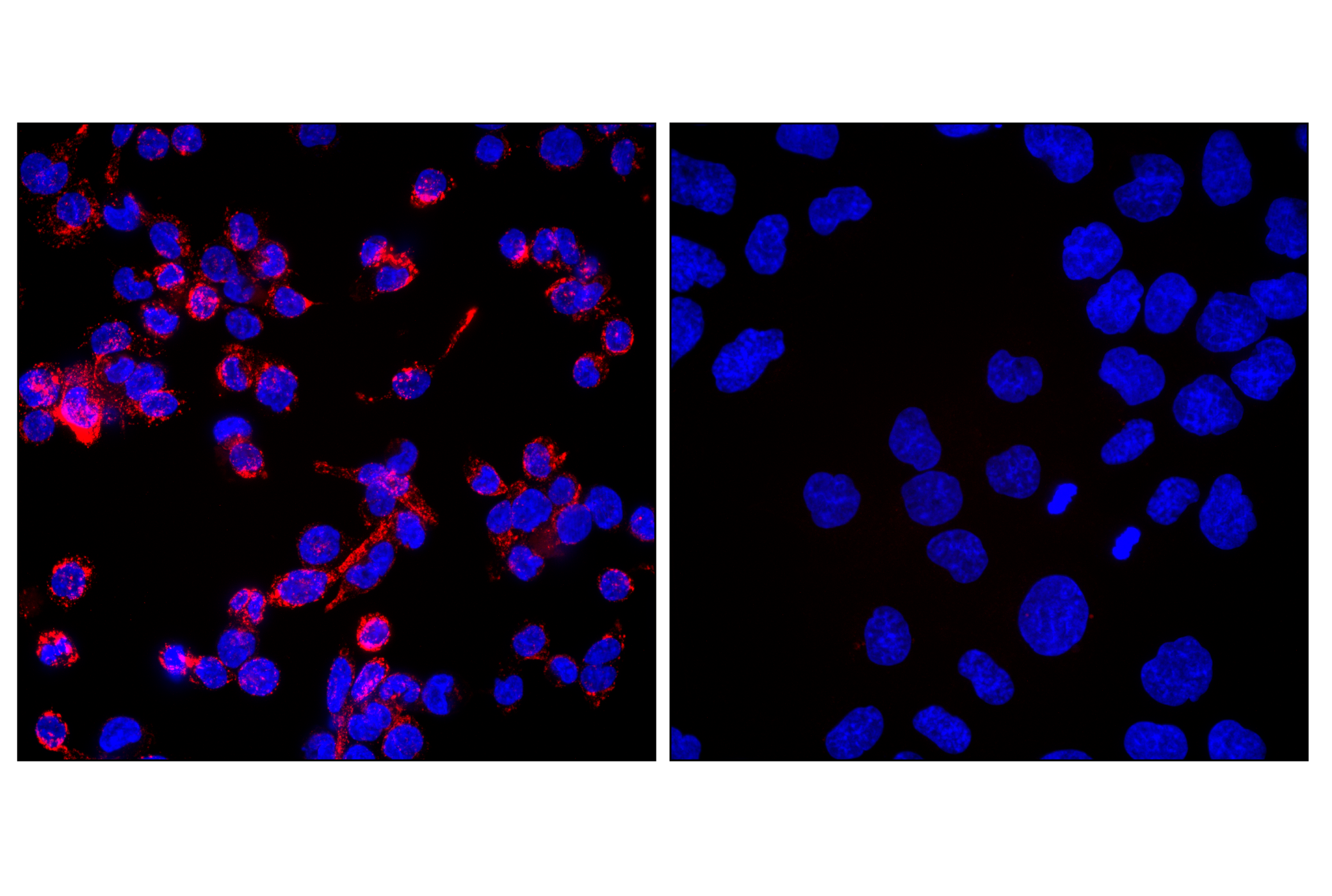 Immunofluorescence Image 1: CD68 (D4B9C) XP® Rabbit mAb (Alexa Fluor® 594 Conjugate)