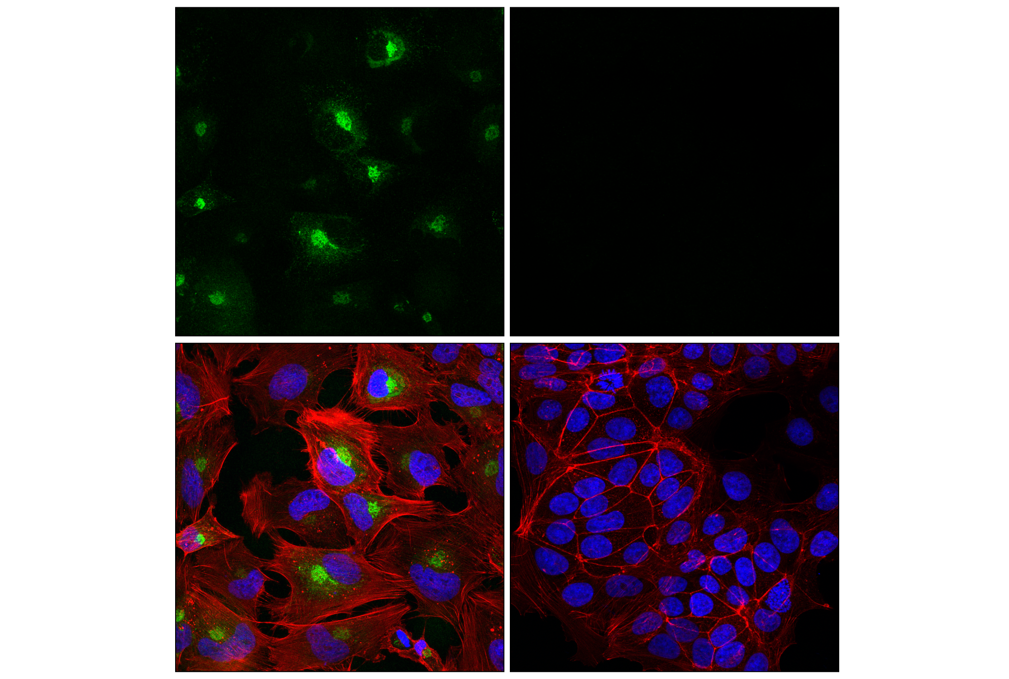 Immunofluorescence Image 1: Periostin (E3X1U) Rabbit mAb