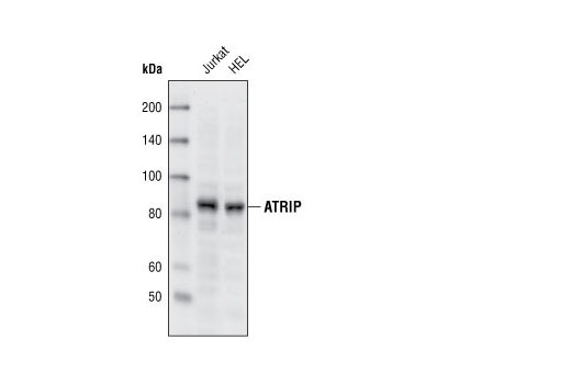  Image 4: UV Induced DNA Damage Response Antibody Sampler Kit
