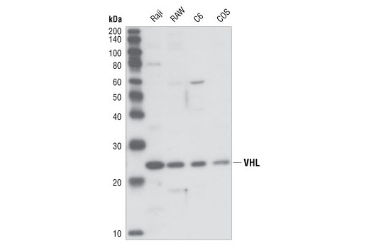 Western Blotting Image 1: VHL Antibody