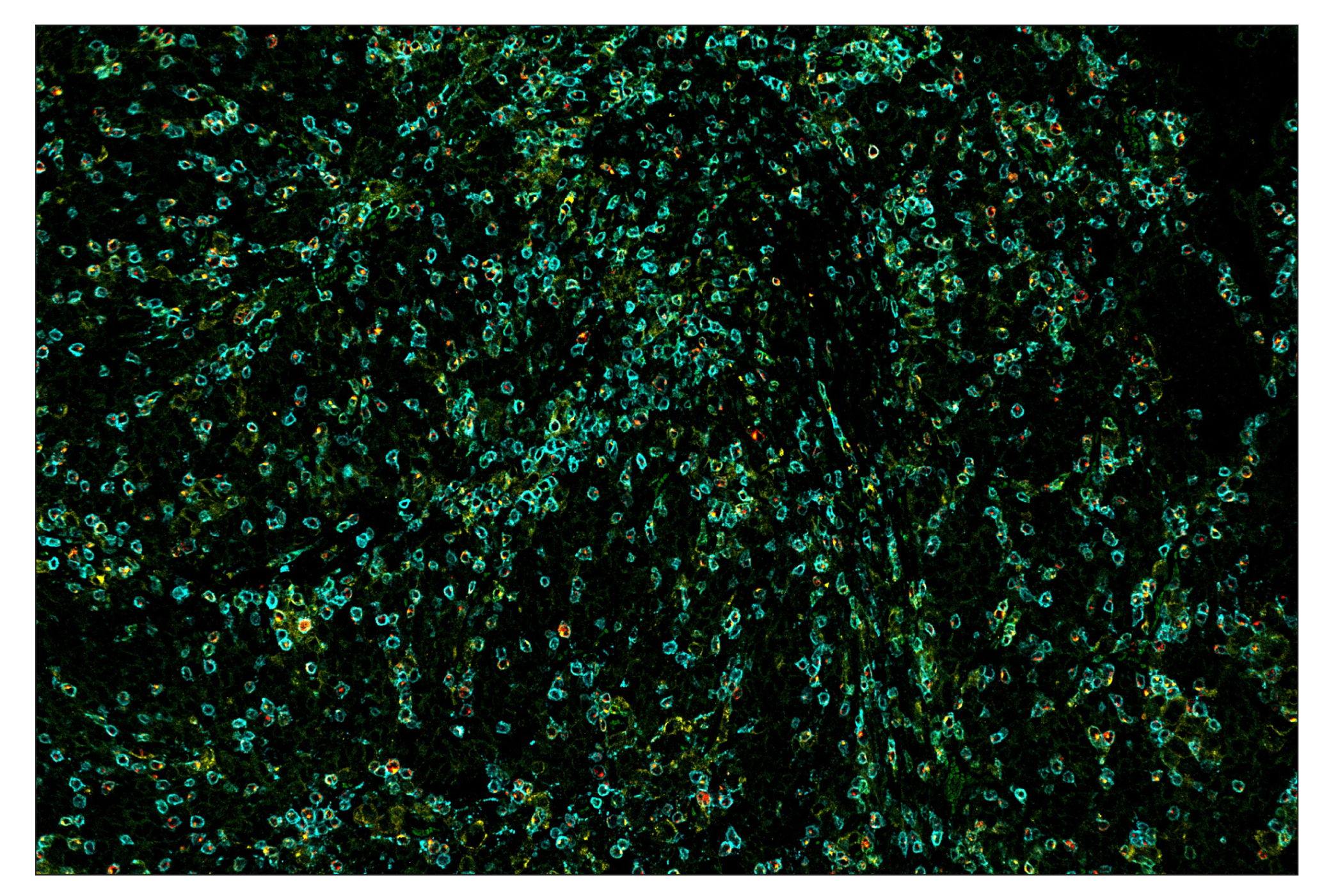 Immunohistochemistry Image 7: CD3ε (D7A6E™) & CO-0001-488 SignalStar™ Oligo-Antibody Pair