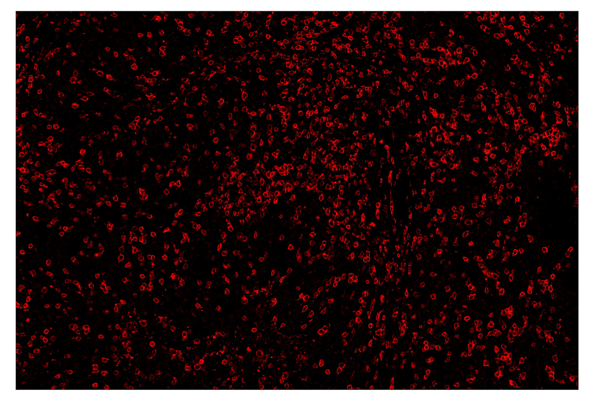Immunohistochemistry Image 4: CD3ε (D7A6E™) & CO-0001-488 SignalStar™ Oligo-Antibody Pair