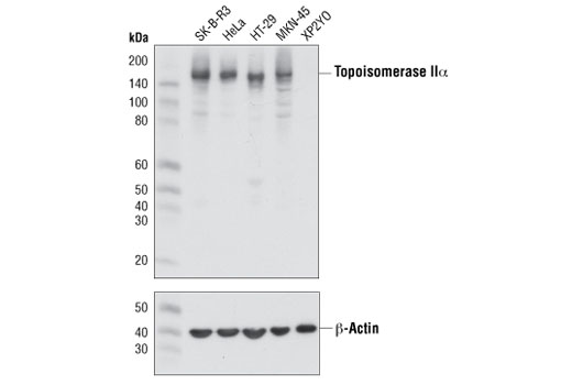 Western Blotting Image 1: Topoisomerase IIα (D10G9) XP® Rabbit mAb (BSA and Azide Free)