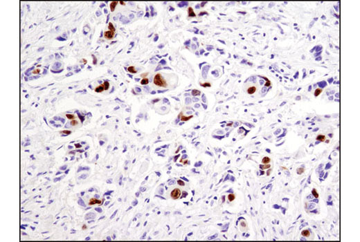 Immunohistochemistry Image 1: Topoisomerase IIα (D10G9) XP® Rabbit mAb (BSA and Azide Free)