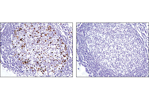 Immunohistochemistry Image 3: Topoisomerase IIα (D10G9) XP® Rabbit mAb (BSA and Azide Free)