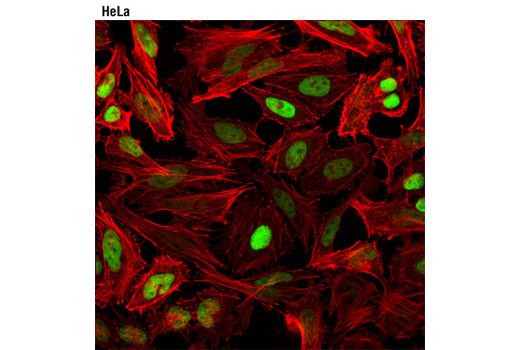 Immunofluorescence Image 1: Topoisomerase IIα (D10G9) XP® Rabbit mAb (BSA and Azide Free)