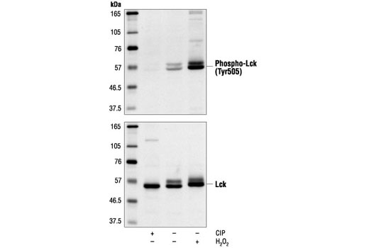 Western Blotting Image 1: Phospho-Lck (Tyr505) Antibody